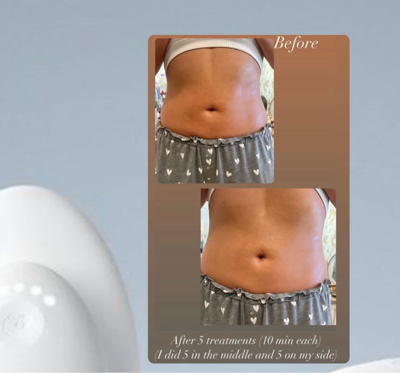 AgeLOC Renuspa iO + free gift: Epoch Glacial Marine Mud | Nu Skin | NuSkin | Brand New