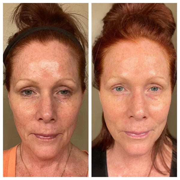 3x Nu Skin Pharmanex Beauty Focus Collagen+ NuSkin before and after