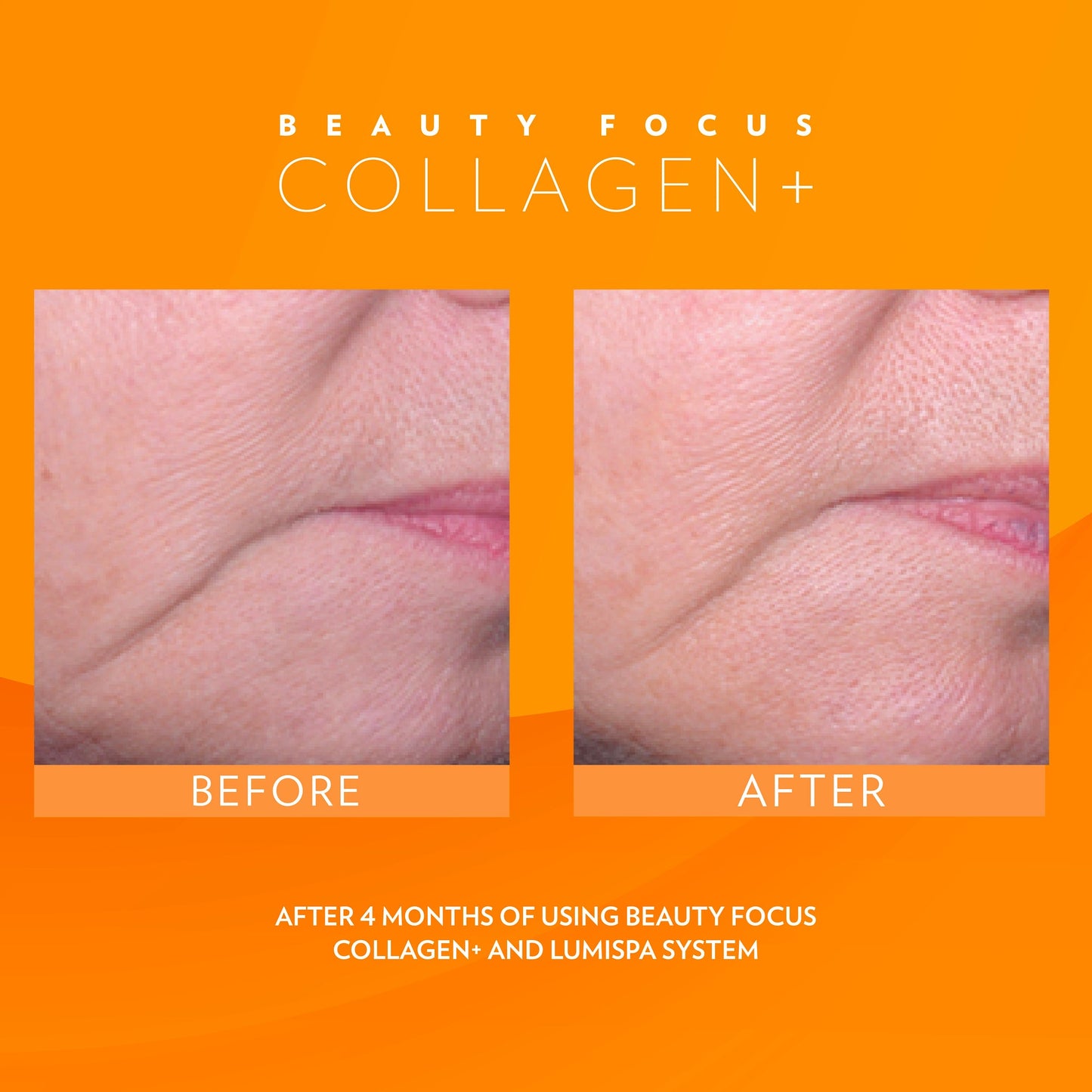 3x Nu Skin Pharmanex Beauty Focus Collagen+ NuSkin before and after