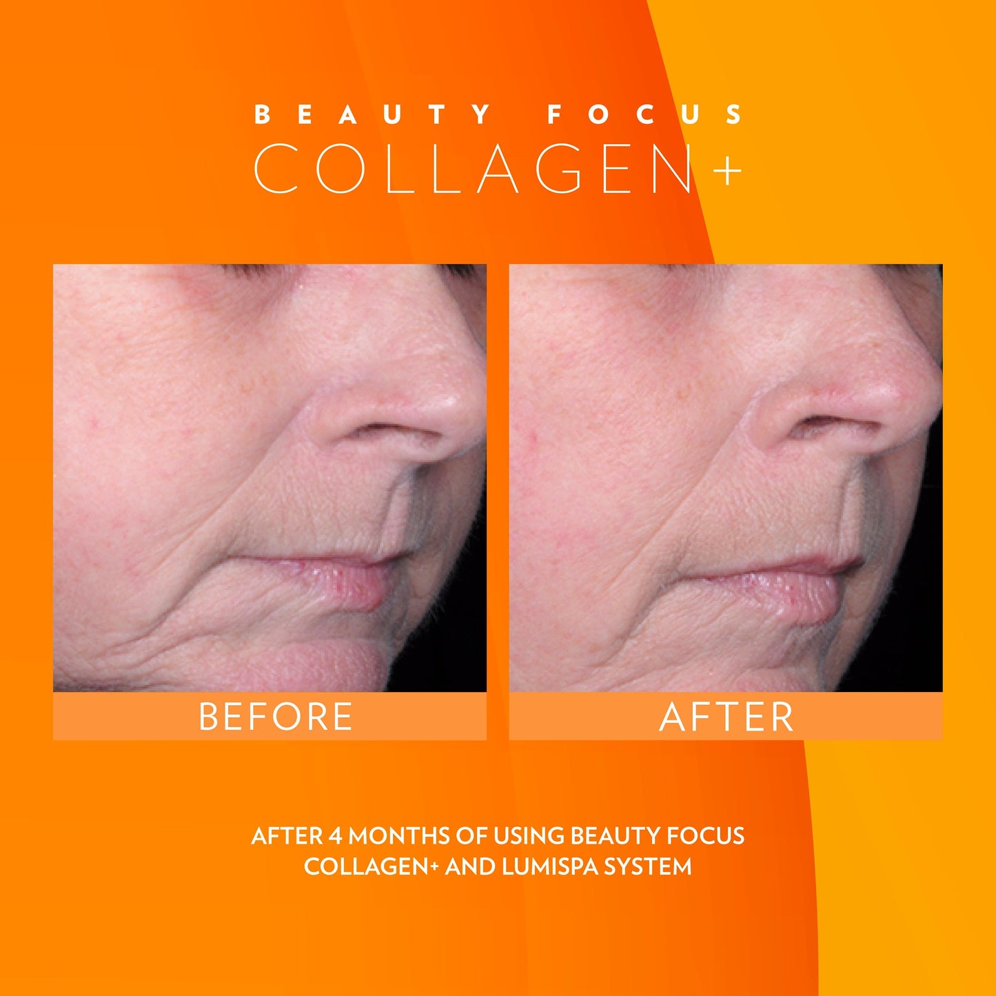 3x Nu Skin Pharmanex Beauty Focus Collagen+ NuSkin before and after
