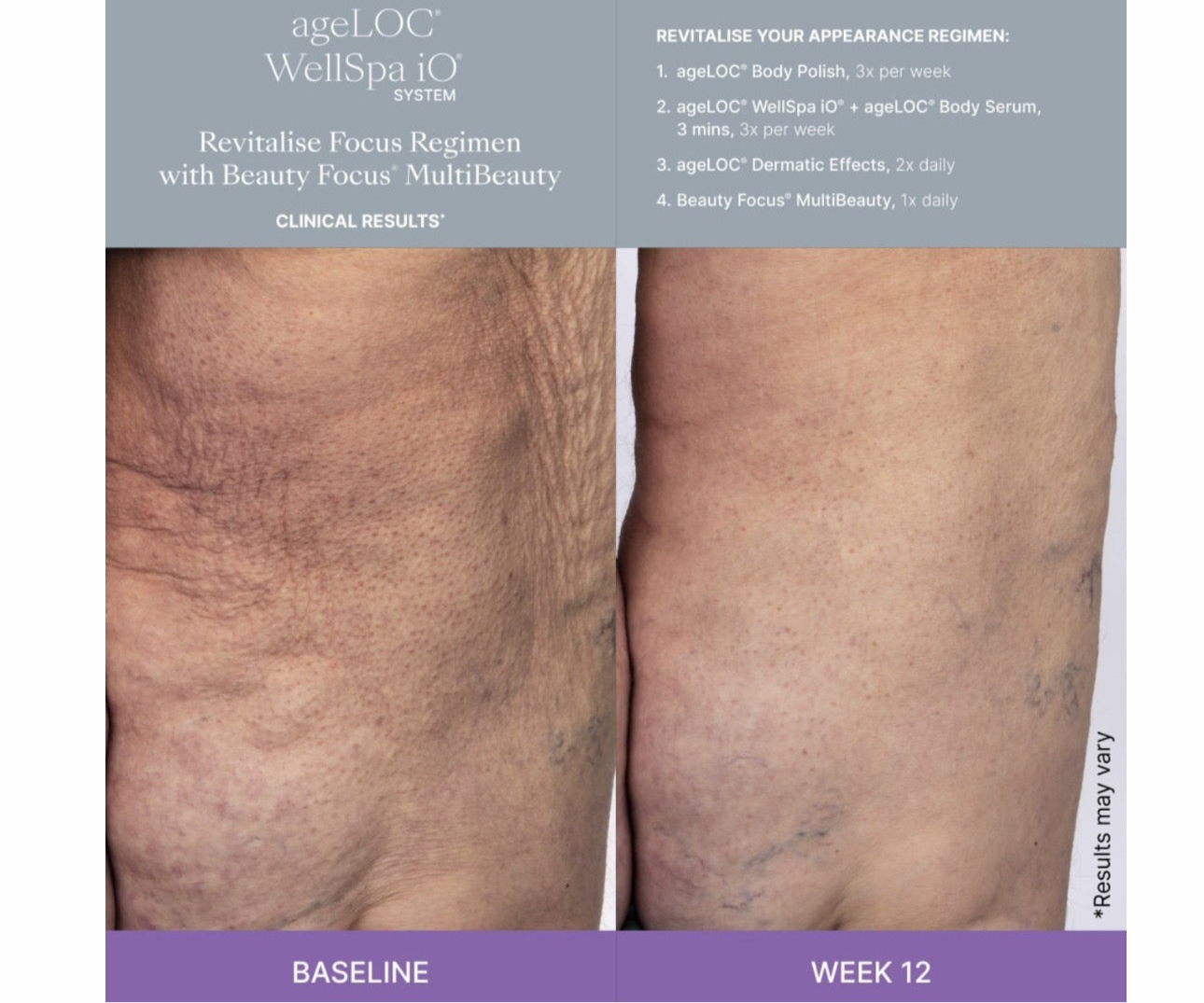 AgeLOC Renuspa iO + free gift: Epoch Glacial Marine Mud | Nu Skin | NuSkin | Brand New
