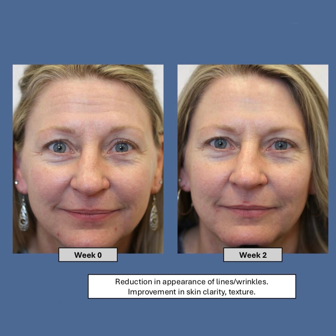 REFILL AgeLoc Tru Face Peptide Retinol Complex | NuSkin | Nu Skin