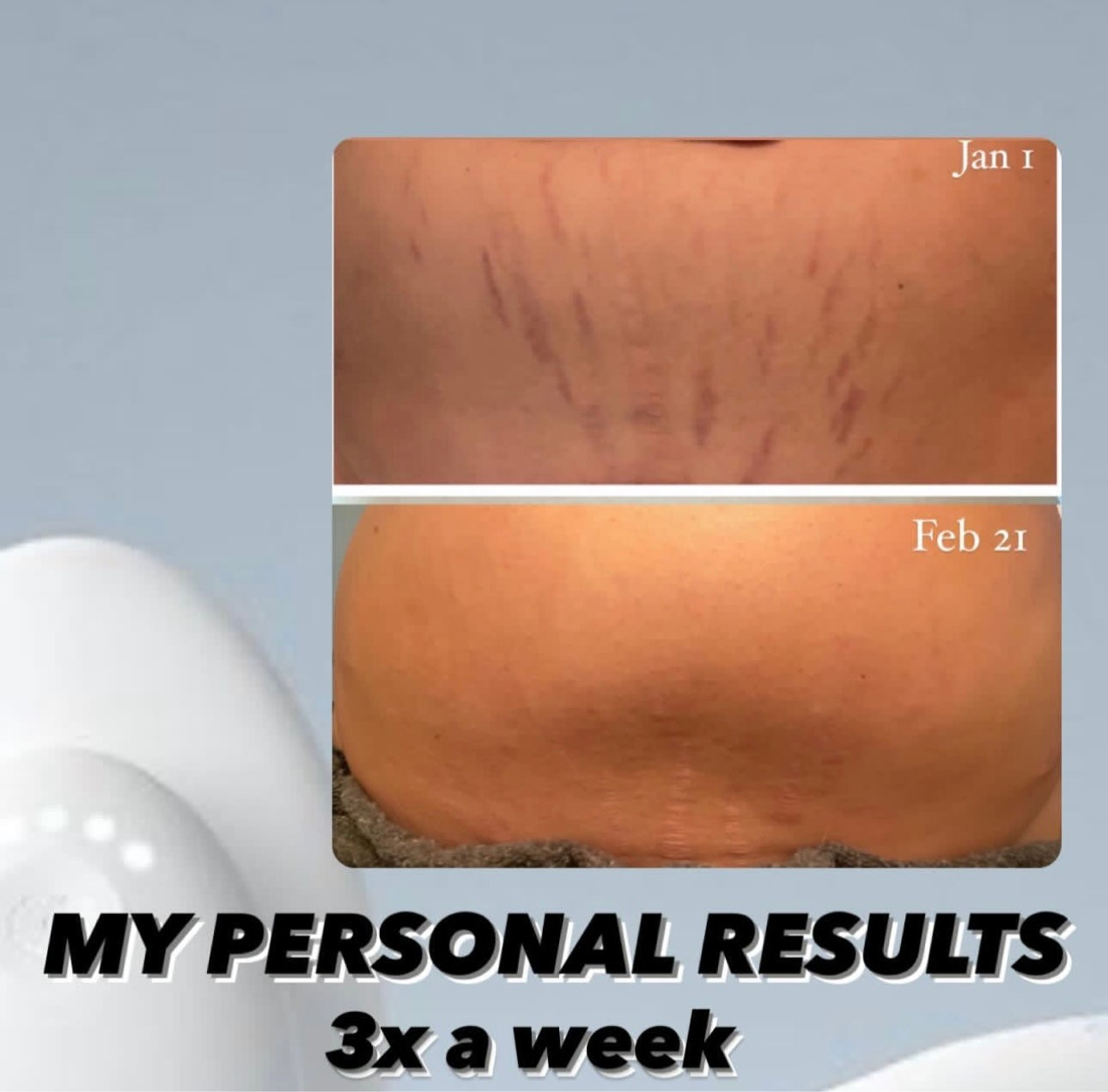 AgeLOC Renuspa iO + free gift: Epoch Glacial Marine Mud | Nu Skin | NuSkin | Brand New