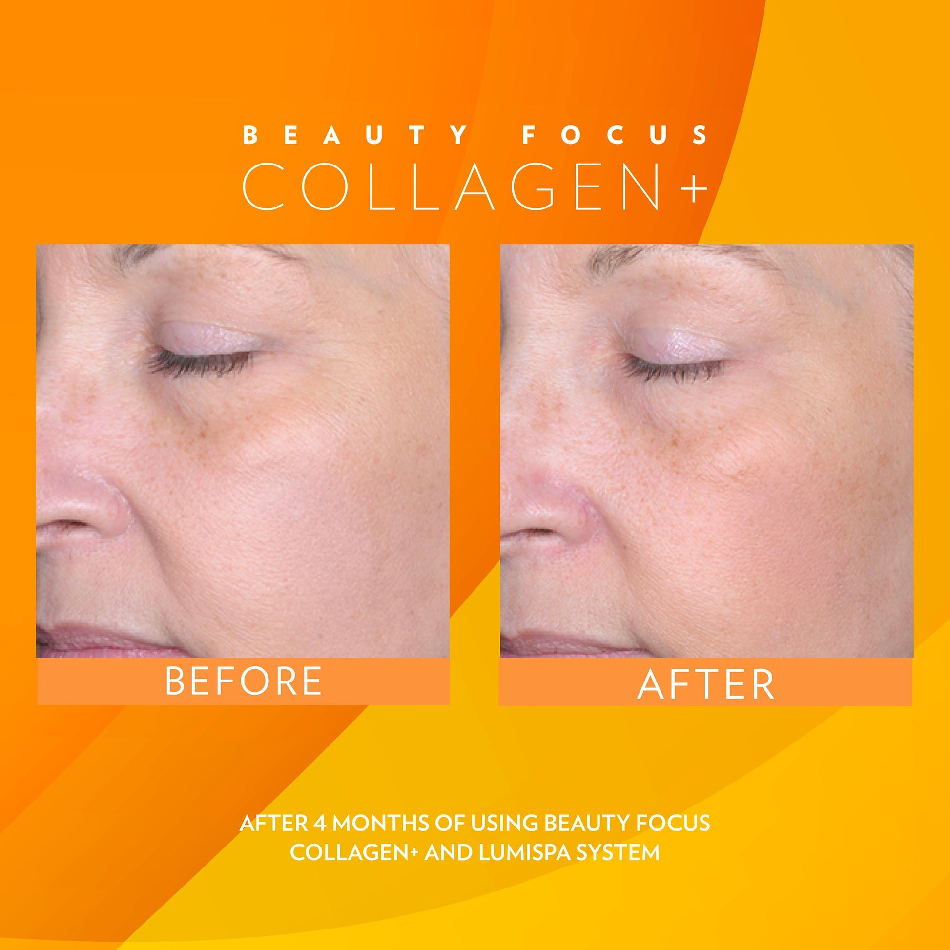 3x Nu Skin Pharmanex Beauty Focus Collagen+ NuSkin before and afters