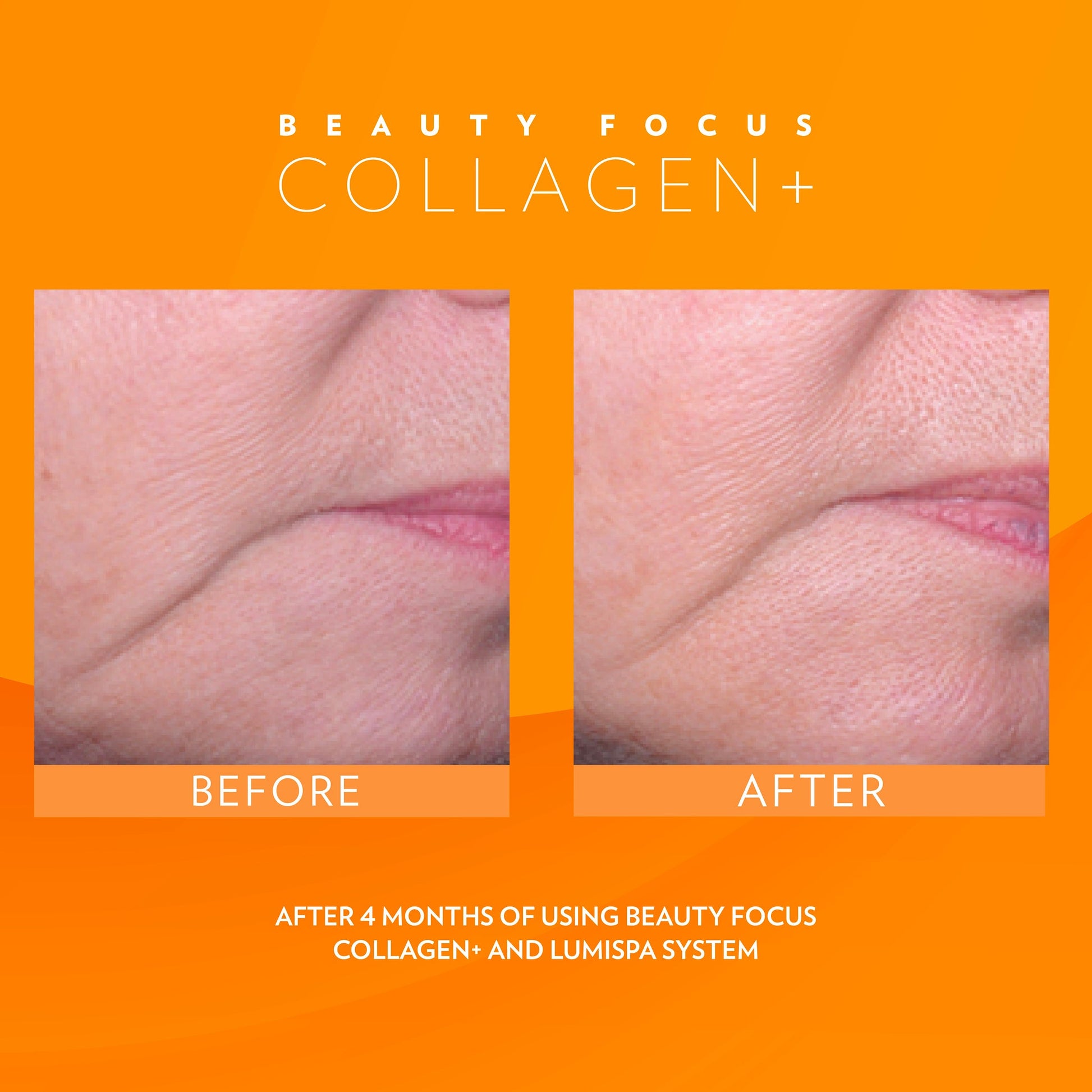 3x Nu Skin Pharmanex Beauty Focus Collagen+ NuSkin before and after