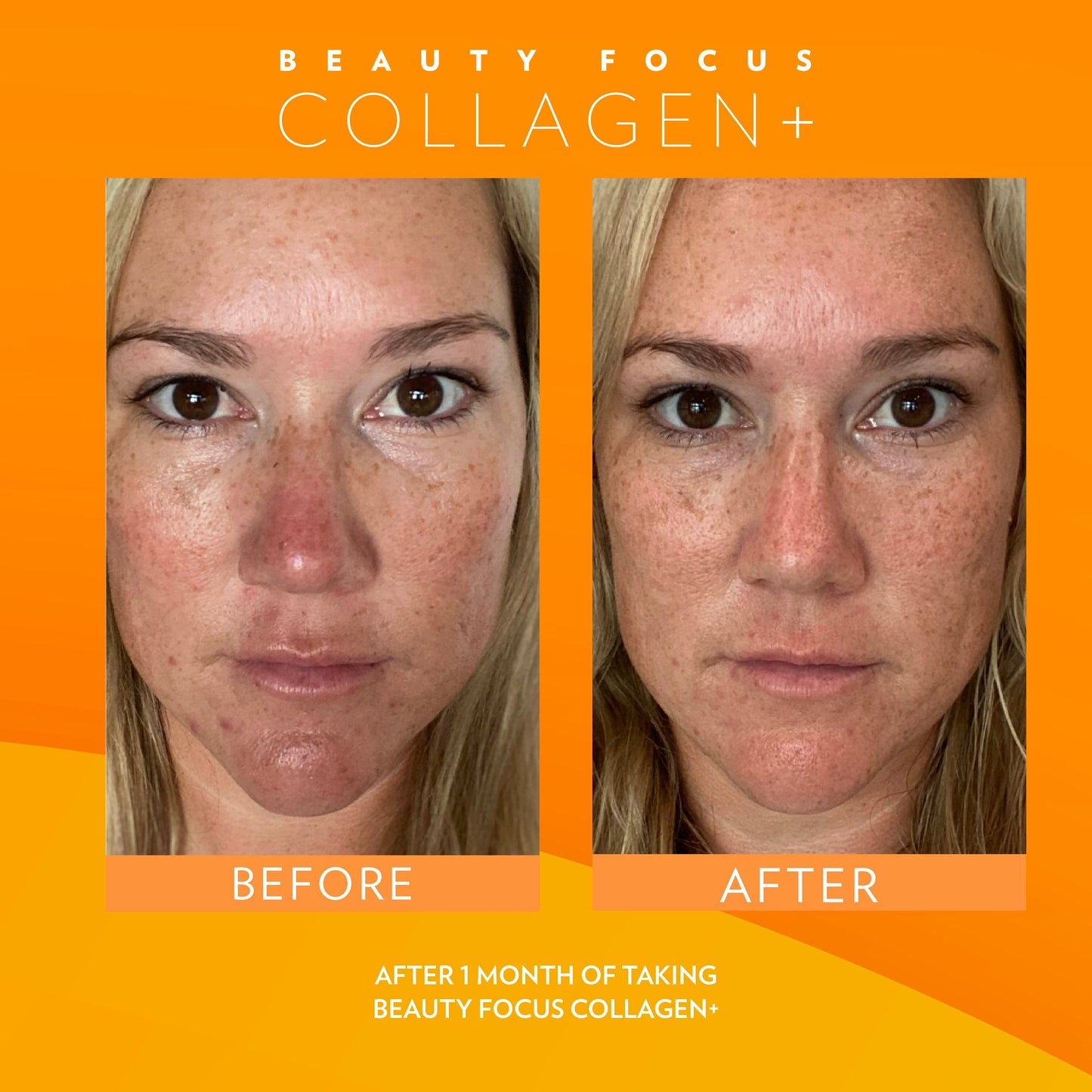 3x Nu Skin Pharmanex Beauty Focus Collagen+ NuSkin before and after