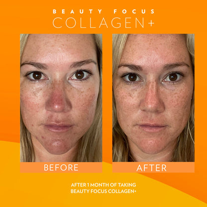 3x Nu Skin Pharmanex Beauty Focus Collagen+ NuSkin before and after