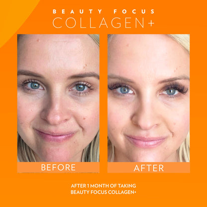 3x Nu Skin Pharmanex Beauty Focus Collagen+ NuSkin before and after