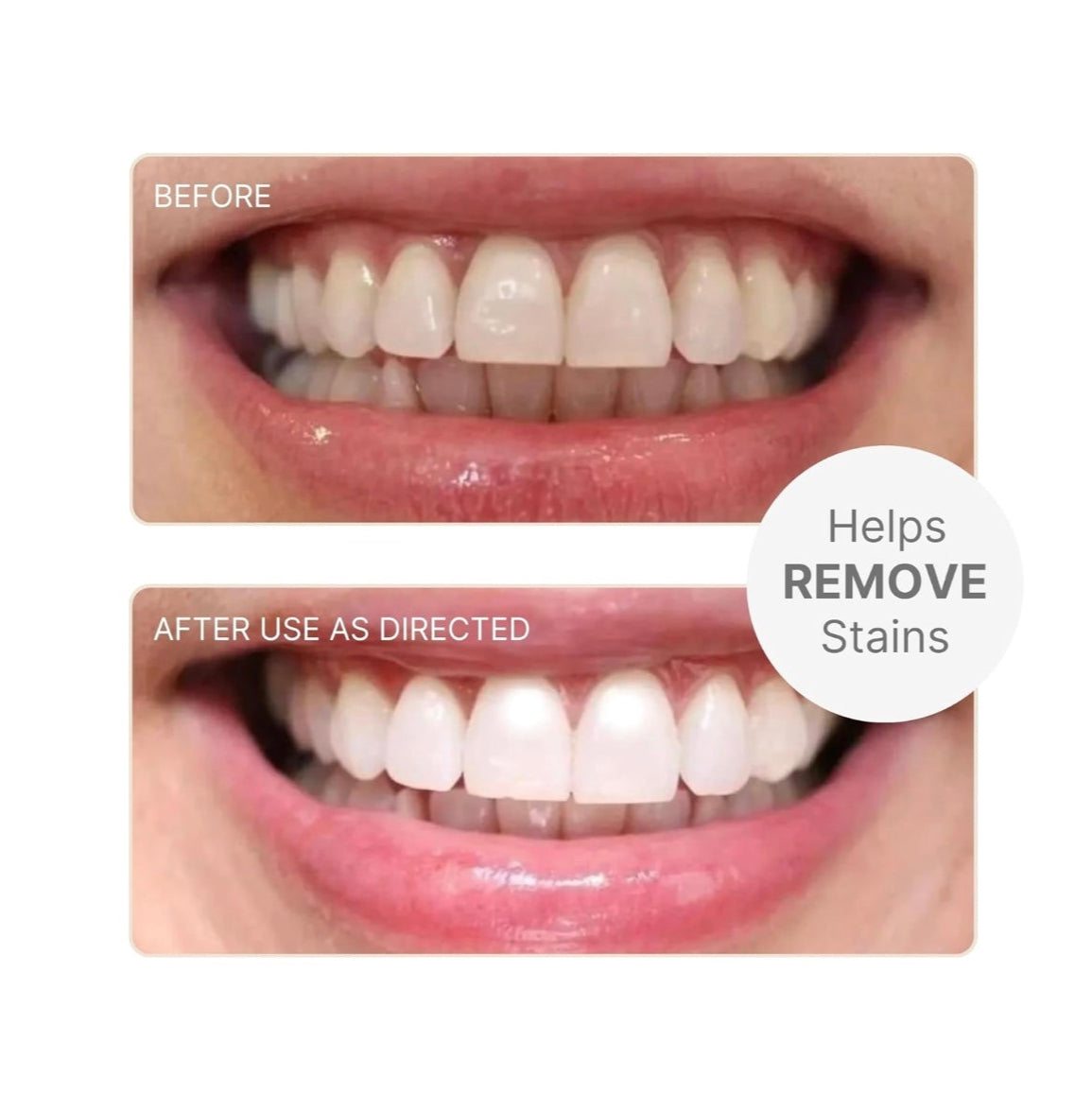 AP24Whitening Fluoride-FREE Helps remove stains