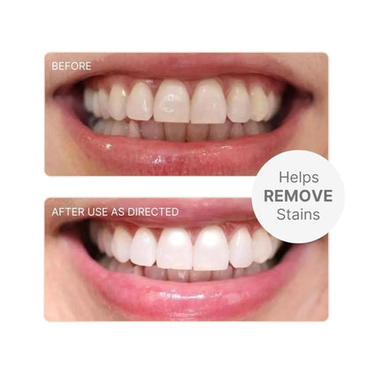 AP24Whitening Fluoride-FREE Helps remove stains