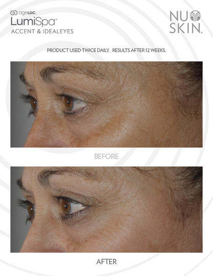 10 x ageLOC Lumispa IdealEyes