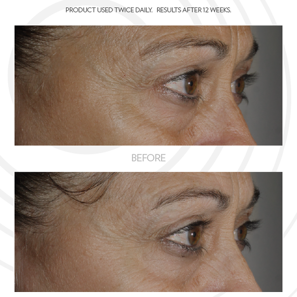 ageloc iealeyes cream for accent 