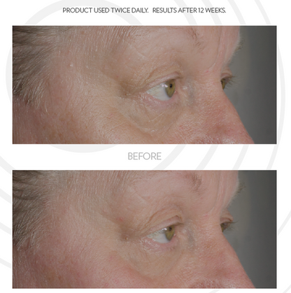 ageloc iealeyes cream for accent  before and after